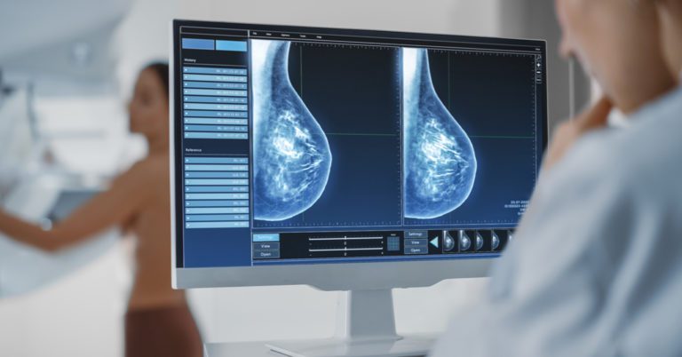 1726639521 Mammography Edit 768X402