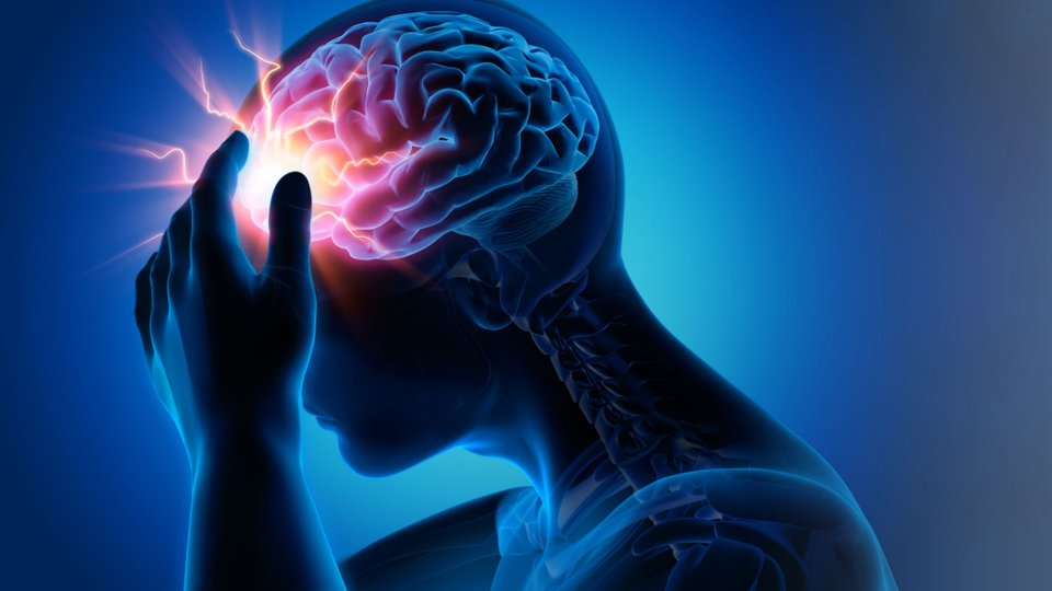 Epilepsi Nedirsi