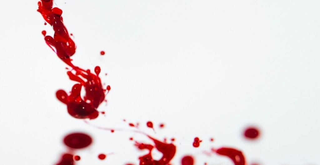 Ruyada Kan Gormek 2 1024X531