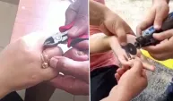 Parmaklarına sıkışan yüzükleri itfaiye çıkardı