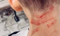 Rehabilitasyon merkezinde 5 yaşında çocuğa darp iddiasına soruşturma