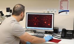 Bilim insanları, Alzheimer hastalığını kan tahliliyle erken teşhis için çalışıyor