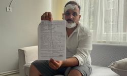 Taksici, eski sözlüsü ve ikizinin polis sevgililerinin kendisini dövdüğünü iddia etti