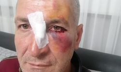 Dairesinin önüne hayvan dışkısı atan komşusundan, bu kez 'yüzüne kapı çarptığı' için şikayetçi oldu