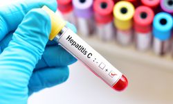 Türkiye’de 500 bin kişi Hepatit C taşıdığını bilmiyor