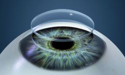 Kornea nakli gözü kurtarıyor