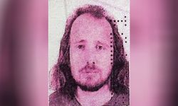 Türkiye'ye saç ekimi ve diş tedavisi için gelen İngiliz hayatını kaybetti