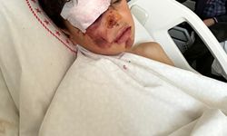 Otomobiliyle 12 yaşındaki bisikletliye çarpıp kaçtı