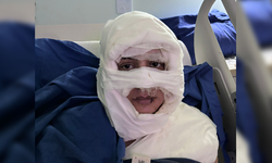 Kadıköy'de kadının üzerine yanıcı madde atan sanığa 4 yıl 6 ay hapis talebi