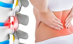 Kadınlarda yük taşımaya bağlı bel fıtığı riski