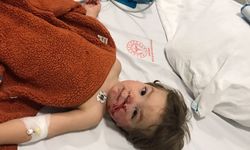 Ankara'da 2 kardeşe saldıran pitbull ve sahibi yakalandı