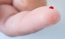 Rüyada Kan Görmek Ne Anlama Gelir? Rüyada Kan Görmek ve Yaralanmak Üzerine Yorumlar