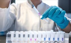 DSÖ, 2024'te 1,3 milyon kişinin AIDS hastalığına yakalandığını bildirdi