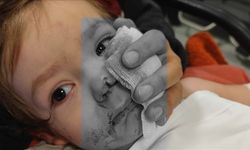 Başkentte 2 çocuğu yaralayan pitbull cinsi köpeğin sahibi tutuklandı