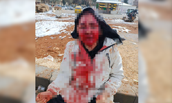 Boşanma aşamasındaki eşini kaldırım taşıyla dövdü