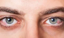 Glokom belirti vermeden ilerliyor: Erken tanı körlüğü önleyebiliyor