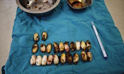 Midesinden 44 kapsül uyuşturucu madde bonzai çıktı