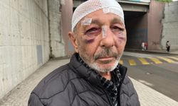 Önce çakmak istediler ardından sokak ortasında darbettiler