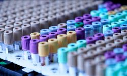 Evcil kedilerdeki kanser araştırmalarının, insanların tedavisinde umut olabileceği bildirildi