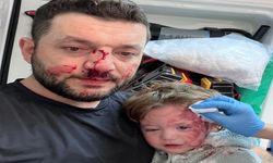 Kucağında bebeği ile darbedilen babanın oğlu, sokakta başına atılan taşla yaralandı