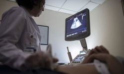 Kadınlardaki sessiz tehlike: Çikolata Kisti 10 kadından birini etkiliyor