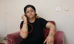 16 yıl dini nikahla birlikte yaşadığı kişi tarafından 30 yerinden bıçaklandı