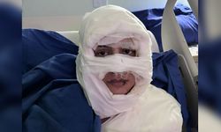 Kadıköy'de üzerine kolonya döktüğü kadını yakan sanık hakim karşısında