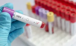 Dünya nüfusunun yüzde 3'ü kronik Hepatit B veya C ile yaşıyor
