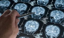 Araştırma: Derin uyku Alzheimer’ı yavaşlatıyor