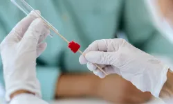 Türkiye'de 16,1 milyon kişiye kanser taraması yapıldı