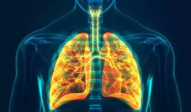 "Akciğer kanseri dünyada giderek artıyor" 