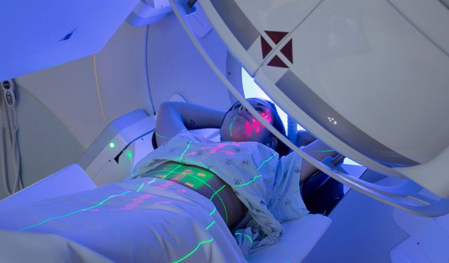 ‘Radyoterapi çoğu kanser türünde etkin bir tedavi yöntemi’