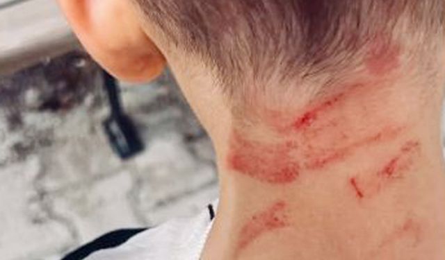 Rehabilitasyon merkezinde 5 yaşında çocuğa darp iddiasına soruşturma