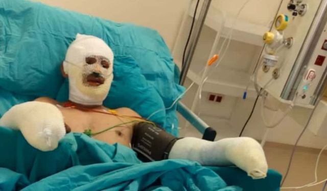 Orman yangınına müdahale sırasında ağır yaralanan eşinin son halini paylaştı