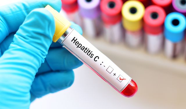 Türkiye’de 500 bin kişi Hepatit C taşıdığını bilmiyor