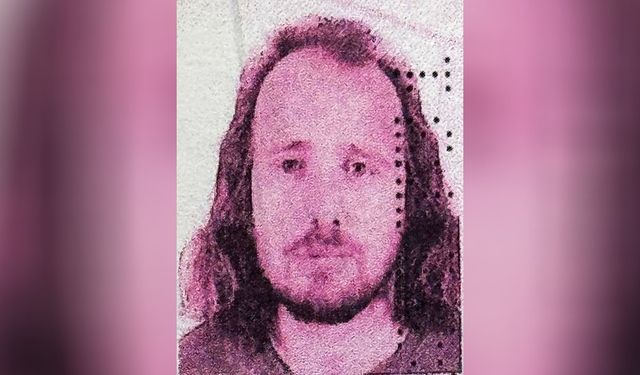 Türkiye'ye saç ekimi ve diş tedavisi için gelen İngiliz hayatını kaybetti