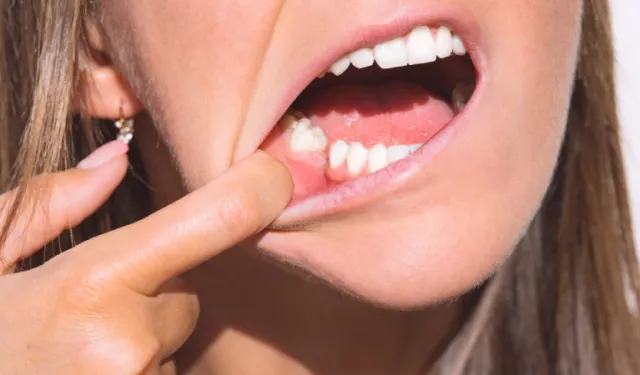 Rüyada dişlerin dökülmesi ne anlama gelir?