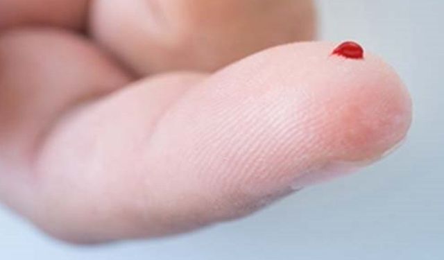 Rüyada Kan Görmek Ne Anlama Gelir? Rüyada Kan Görmek ve Yaralanmak Üzerine Yorumlar