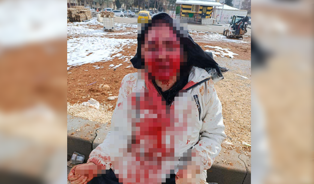 Boşanma aşamasındaki eşini kaldırım taşıyla dövdü