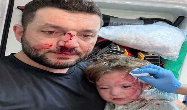 Kucağında bebeği ile darbedilen babanın oğlu, sokakta başına atılan taşla yaralandı