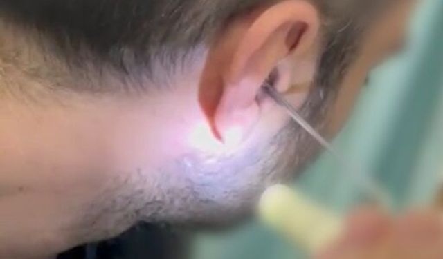 Kulağına gizlediği uyuşturucuyla yakalandı