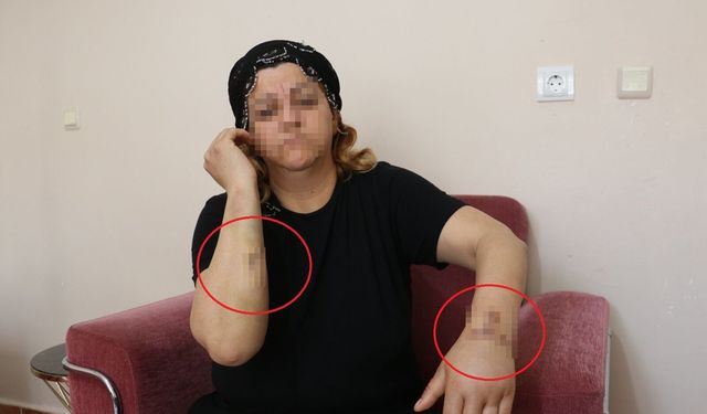 16 yıl dini nikahla birlikte yaşadığı kişi tarafından 30 yerinden bıçaklandı