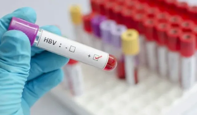 Dünya nüfusunun yüzde 3'ü kronik Hepatit B veya C ile yaşıyor