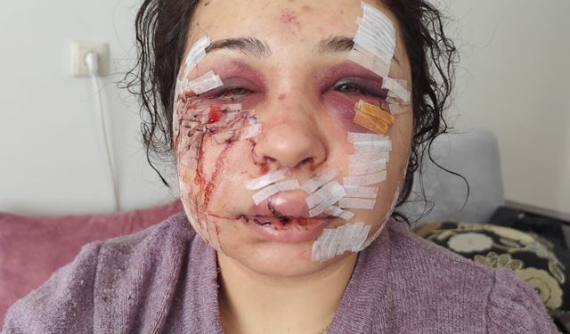 Boşanma aşamasındaki eşini darbeden polis memuruna hapis ve tahliye