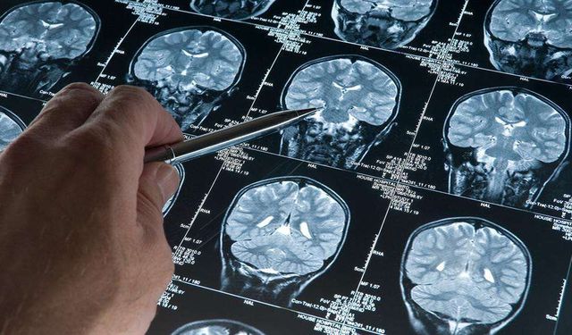 Araştırma: Derin uyku Alzheimer’ı yavaşlatıyor