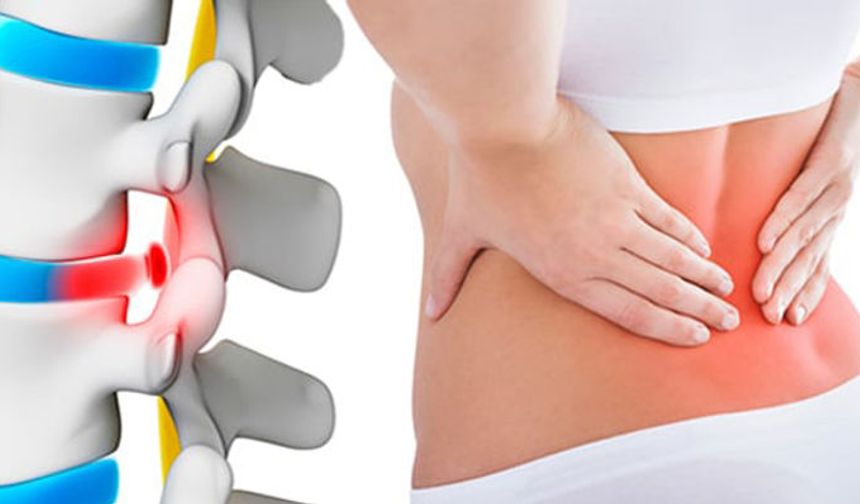 Kadınlarda yük taşımaya bağlı bel fıtığı riski