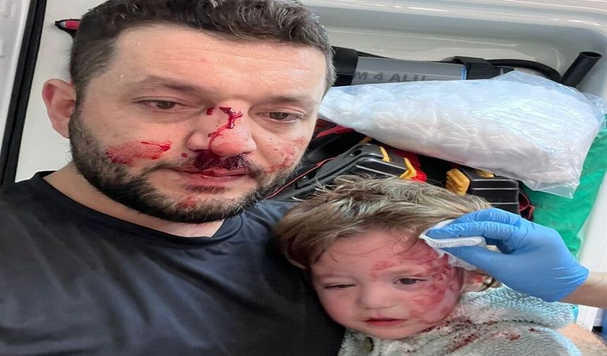 Kucağında bebeği ile darbedilen babanın oğlu, sokakta başına atılan taşla yaralandı