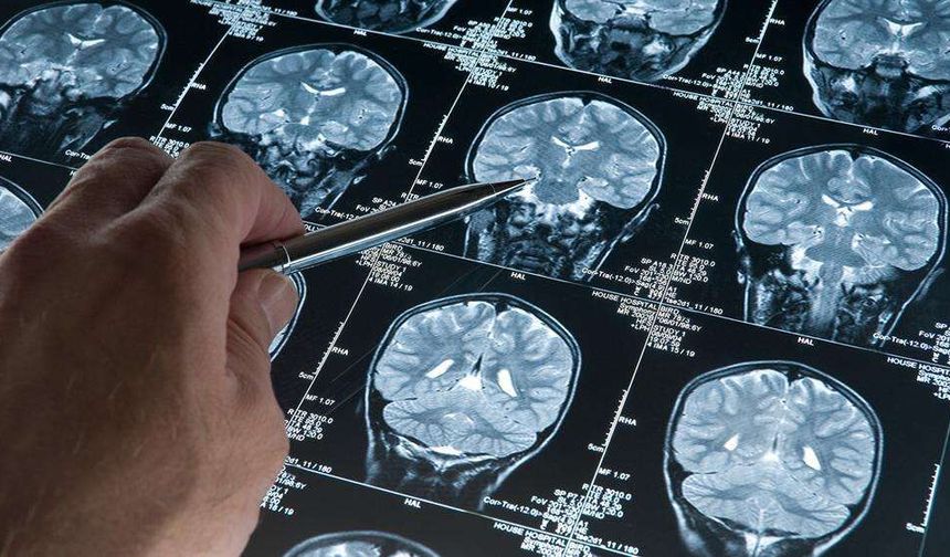 Araştırma: Derin uyku Alzheimer’ı yavaşlatıyor